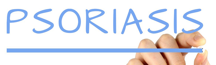 Psoriasis_ una_enfermedad_grave_y_sin_cura_de_la_piel_slide.jpg