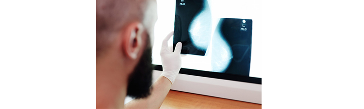 que-es-una-mamografia-web.jpg